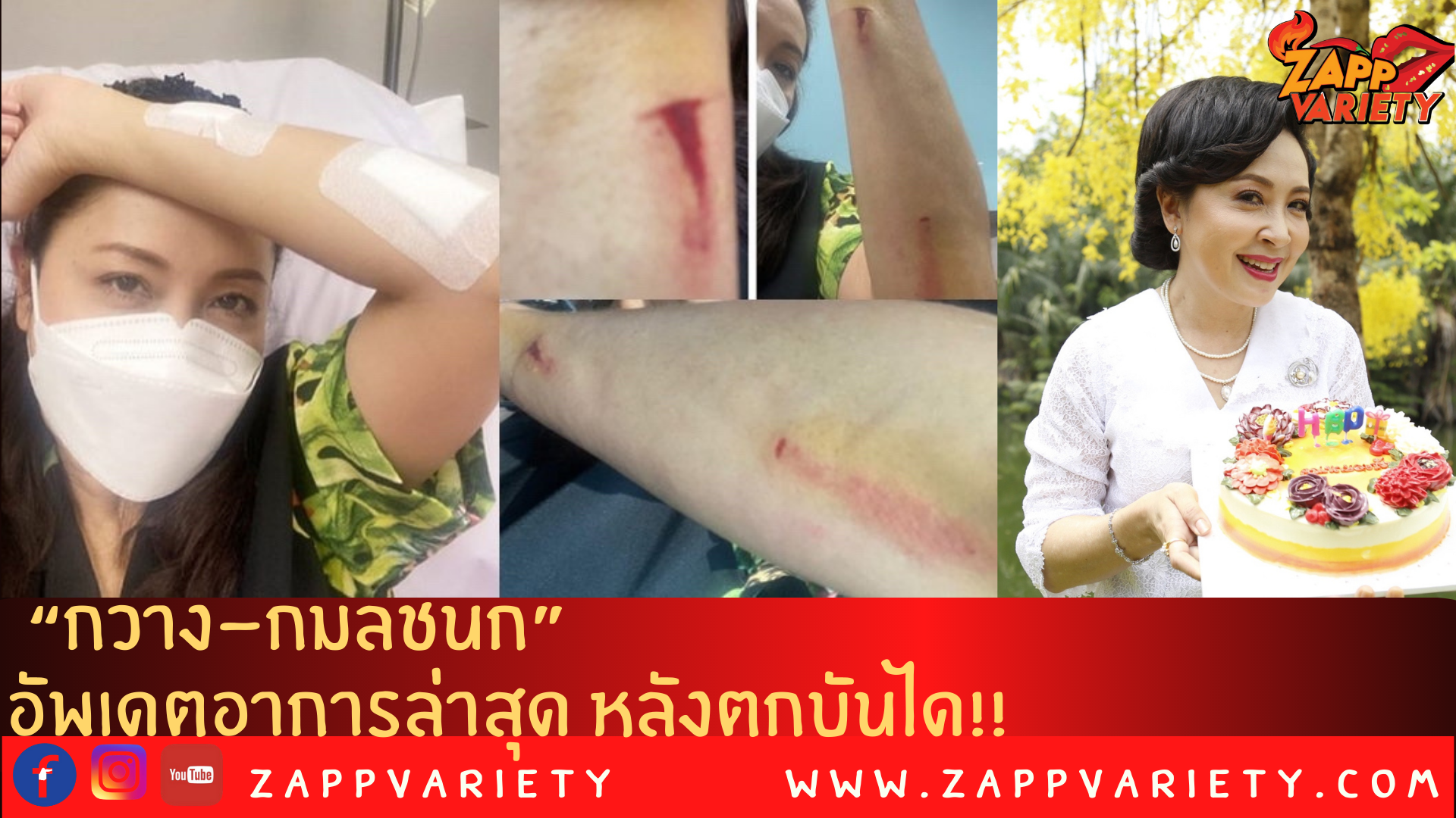 “กวาง-กมลชนก” อัพเดต อาการล่าสุด หลังตกบันได ฟาดเคราะห์ รับวันเกิด!!!