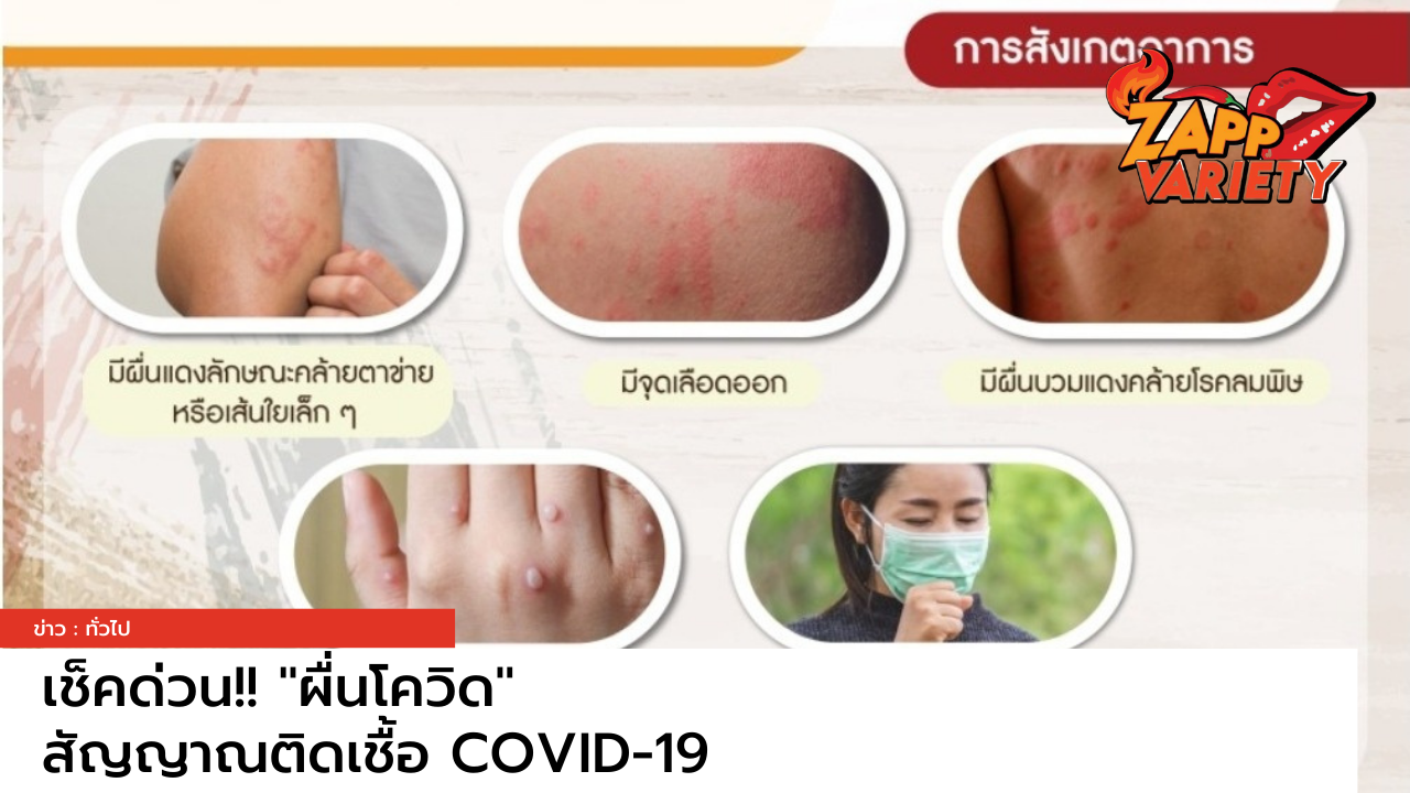 5 ข้อสังเกตอาการ "ผื่นโควิด" สัญญาณทางผิวหนังที่อาจเกิดจากเชื้อ COVID-19