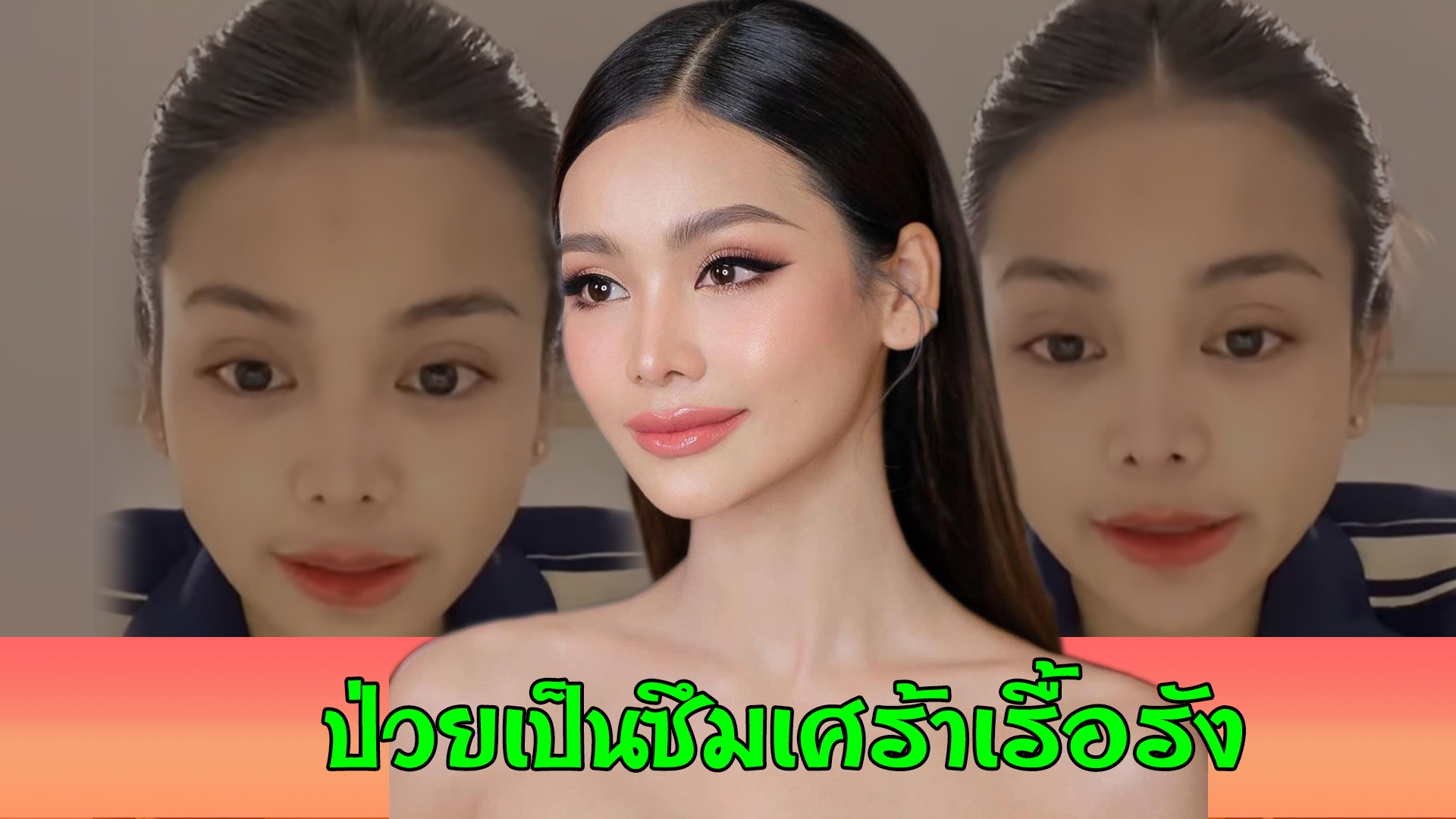 แฟนคลับเป็นห่วง "อิงฟ้า วราหะ" เปิดใจ รับเป็นโรคซึมเศร้า ขั้นเรื้อรัง
