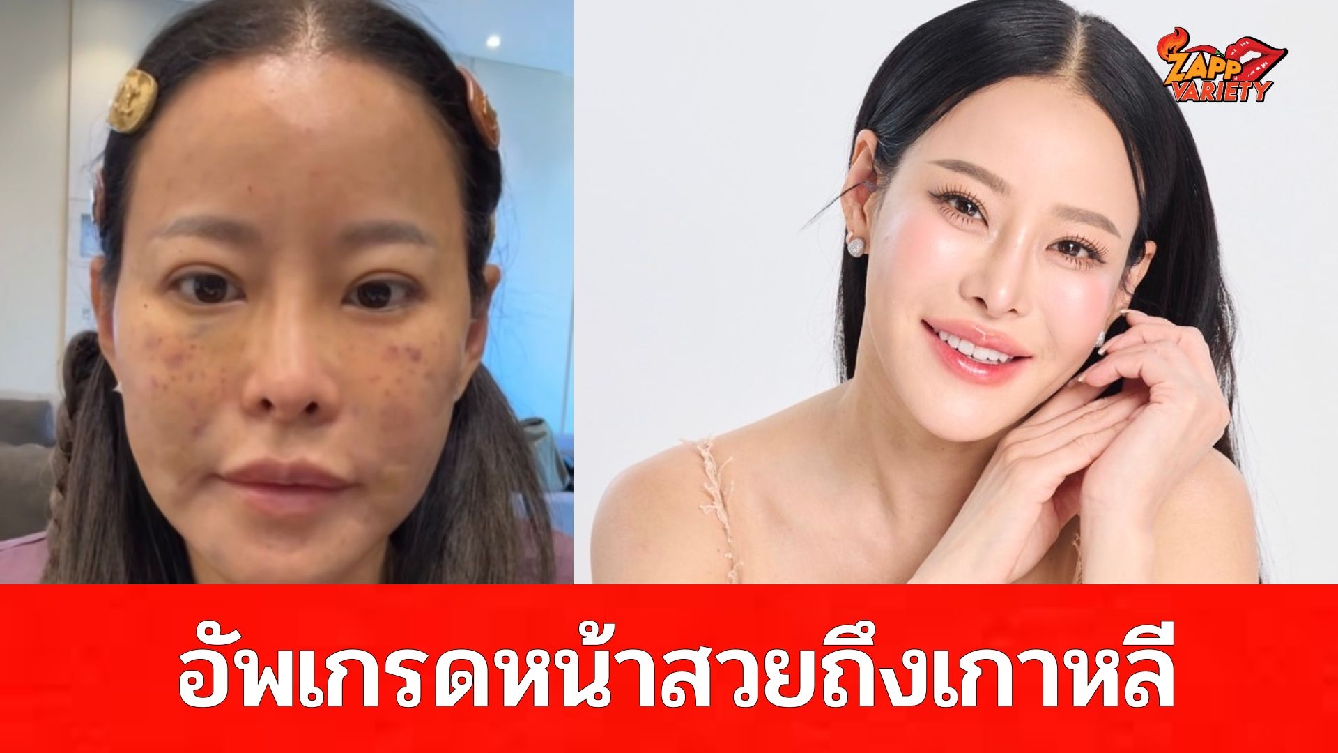 “หนิง-ปณิตา” บุกเกาหลีเสริมความสวย!! พร้อมเผยเคล็ดลับ หน้ายุบบวม ไม่ทิ้งรอยช้ำบนใบหน้า